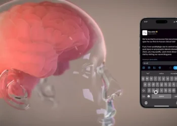 صورة توضح طريقة تركيب شريحة دماغية من شركة نيورالينك