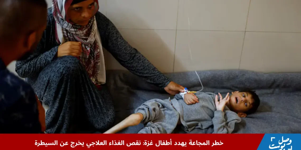 طفل في غزة يتلقى العلاج داخل مركز صحي وسط نقص حاد في الغذاء العلاجي وسوء التغذية المتفاقم